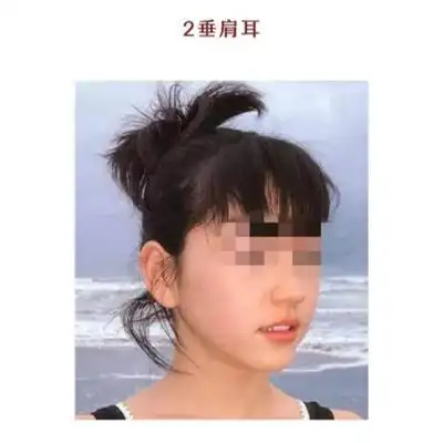 3,棋子耳棋子耳的耳形较小,轮廓圆润且规整,看上去饱满润泽,状如棋子.