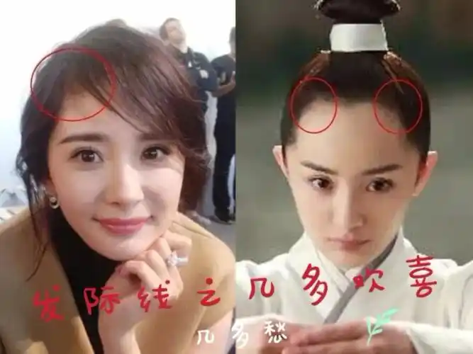 90后脱发发际线后移的事情频频上热搜