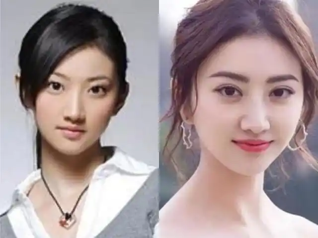 景甜自曝整形失败:昔日甜美形象与今日大不同,网友表示要认真