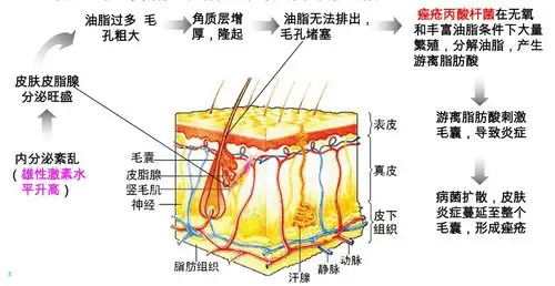 看皮肤科医生如何教你只留青春不留痘