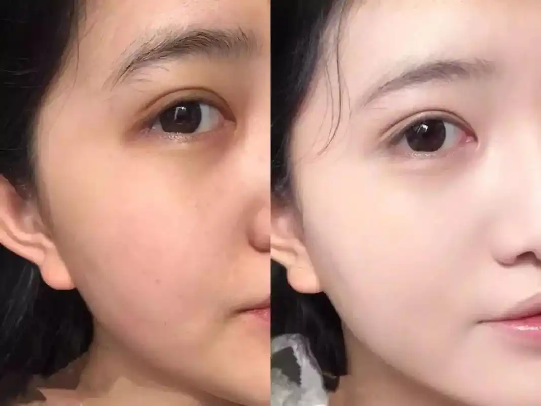 有了ta,遮瑕提亮,10秒就能get少女的粉嫩奶油肌!_皮肤