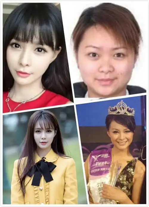 沈梦辰整容前旧照曝光 揭其颜值变化史