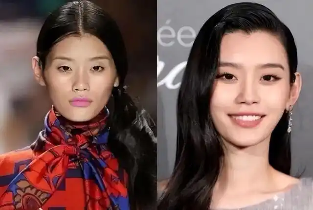 奚梦瑶整容了鼻翼缩小面部填充戴钻戒秀恩爱