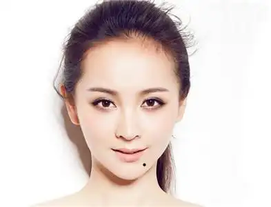 脸上有美人痣的命运如何
