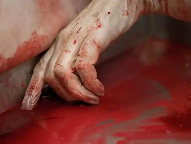 法医严肃捧脑浆 专业让他们没时间害怕_未解之谜网