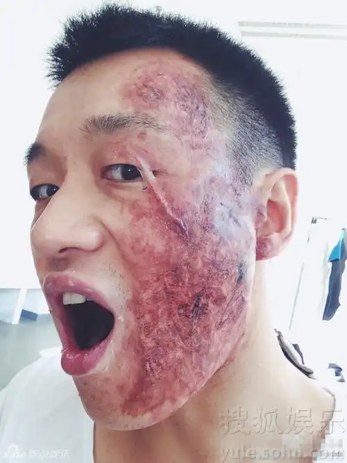 手撕脸皮新技能!佟大为晒逼真烧伤妆