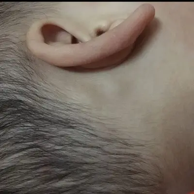 宝宝一岁多,请问左边耳朵后面,摸上去硬硬的,要紧吗,该看什么科?