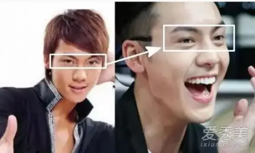 陈伟霆整容前塌鼻圆脸不敢认曝陈伟霆整容前后大对比