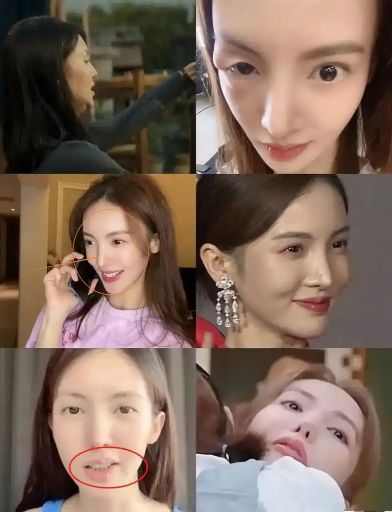 金晨的鼻子真让人担心她还能呼吸吗,其实她原来就很漂亮了.