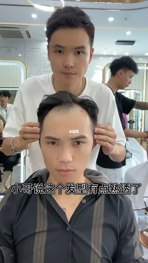 头发少秃顶怎么做发型显年轻又好看呢