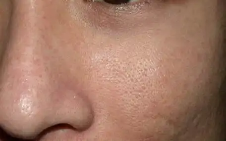 睡前1个小方法,彻底告别毛孔粗大!做紧致女人!