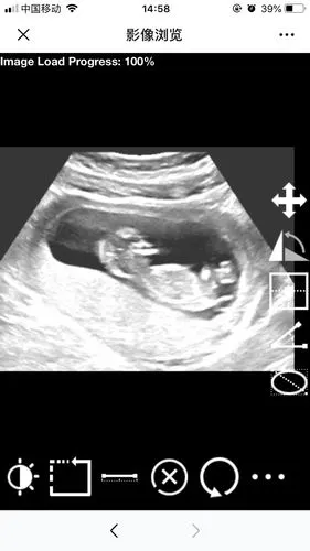 有宝妈会通过nt看男女的嘛