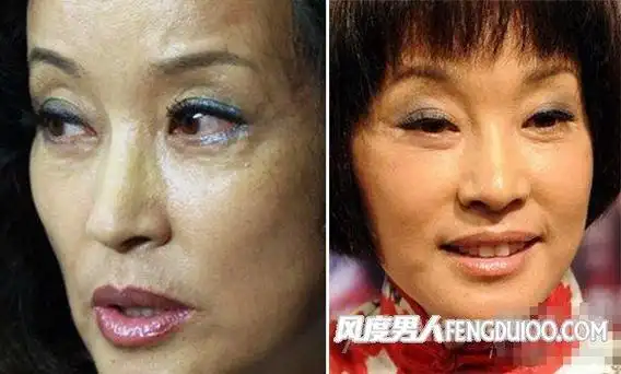 星热点:刘晓庆整容前后照片 刘晓庆年轻时照片