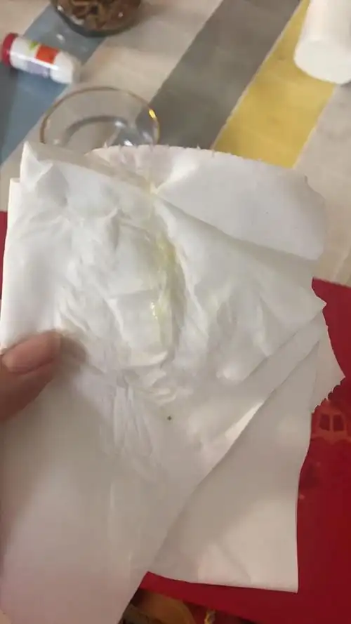 排卵的第五天,有拉丝