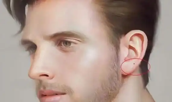 耳垂有痣的男人 男人耳垂有痣命好吗