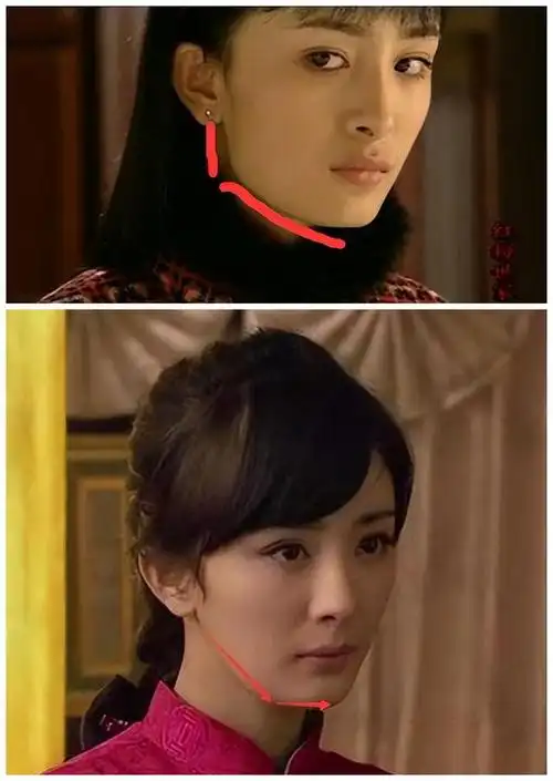 一个人是否在脸上进行过大规模施工,一个很简单的方法,就是看脸部颌骨