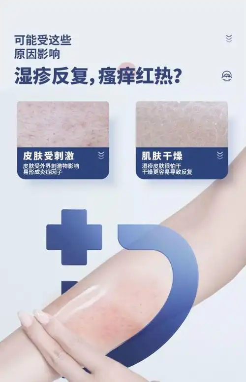 【官方旗舰】皮肤康冷敷凝dr凝胶湿ii疹皮肤过敏止痒去瘙痒毒止痒 一