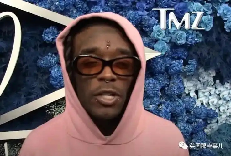 还记得那个往脑门镶颗大粉钻的美国rapper么!结果被粉丝抠掉了?