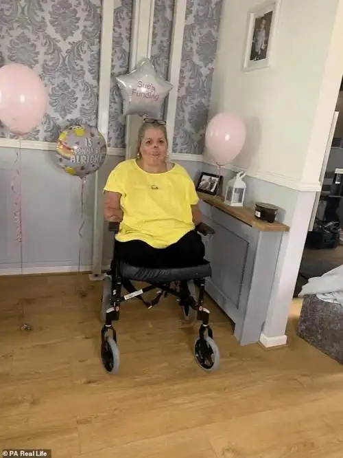 看牙医后留下小伤口女子因此被截去四肢毁掉半张脸