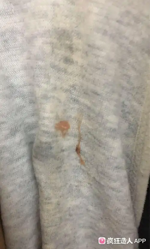 排卵期白带带粉色血丝是怎麼回事?