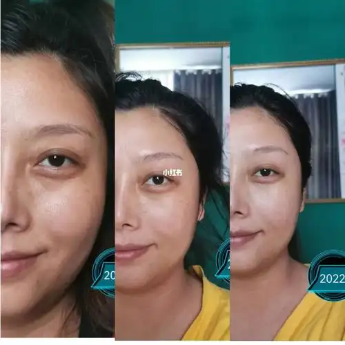 脸部美白大作战对比图