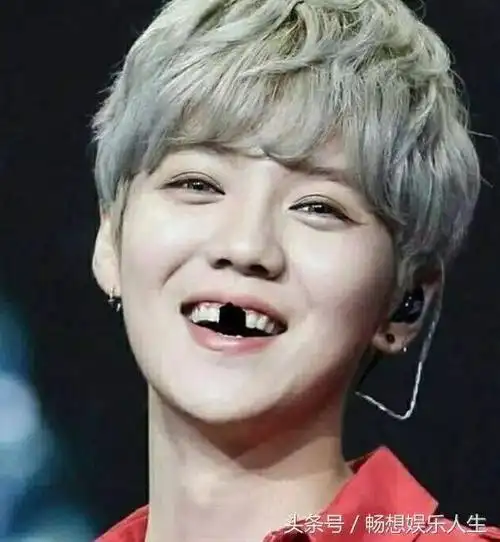 这些明星缺少门牙的尴尬瞬间,网友:心疼鹿晗