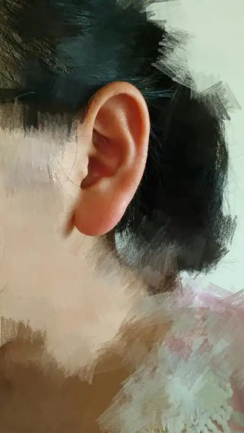 我的耳朵适合扎耳洞么?_百度知道