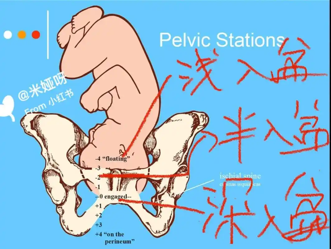 这过程中有浅入盆和深入盆之分.