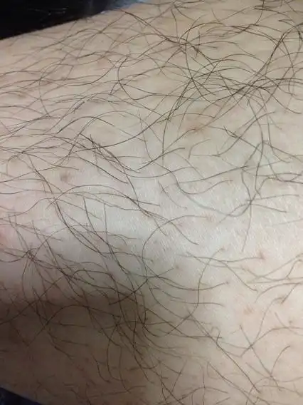 腿毛又黑又重又硬又长咋办 腿还白