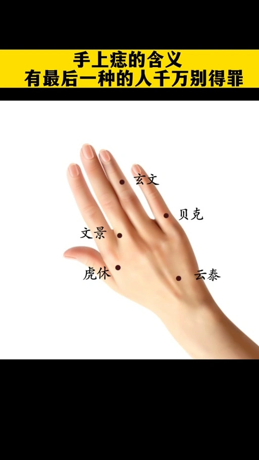 痣图解大图_女生右手长痣图解大图_手背长痣图解大图 - 抖音