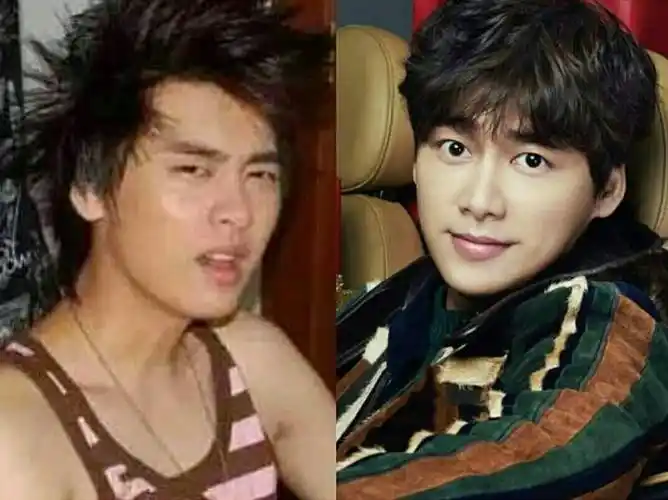 鹿晗整容之前这么丑(鹿晗整容之前这么丑吗)