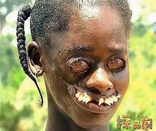 盘点世界上最丑的人,丑到极还有娇妻相伴/结婚5年8个孩子(2) — 探灵