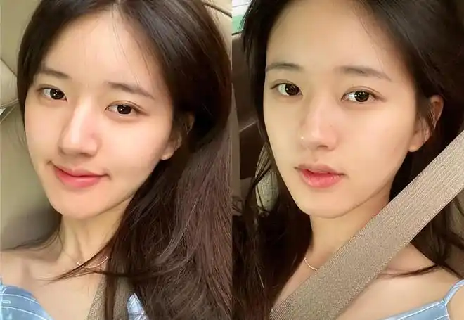 有种"毁容"叫女明星卸妆,素颜照有几个敢说天生丽质?