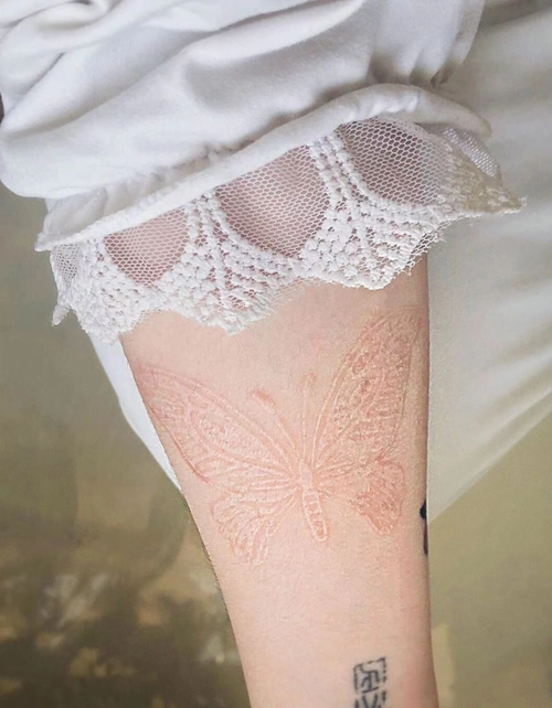 手臂蝴蝶肉雕纹身恢复图超好看的割皮纹身恢复图片欣赏8