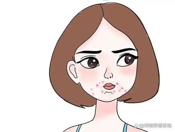 让你长痘痘的真正原因,其实很多人都不知道!