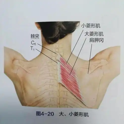 菱形肌在哪儿?今天我们就一次性来说清这块肌肉在哪儿?为什么会损伤?