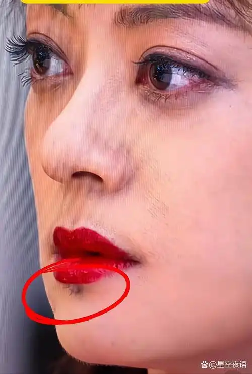 老天爷,孙俪这个痣长毛了,还被镜头这样赤裸裸的拍出来了!