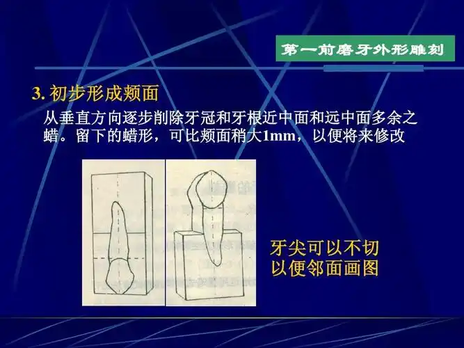 上颌第一前磨牙外形雕刻