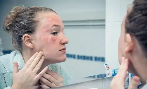 吃虾要不要去"虾线"?|过敏|重金属_网易订阅