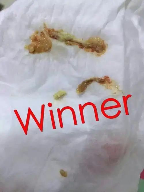 妇科疾病再不是什么大不了的问题