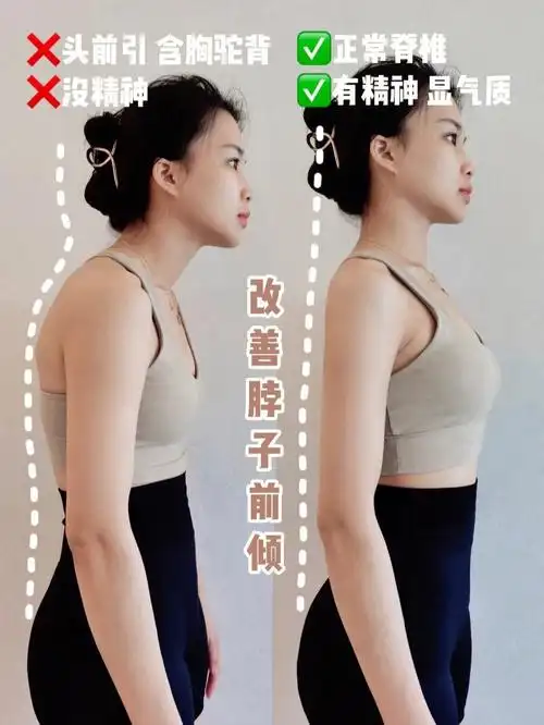 矫正脖子前倾6招养成好体态为气质加分