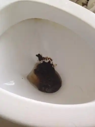 我便秘今天大便几乎黑色这是怎么了