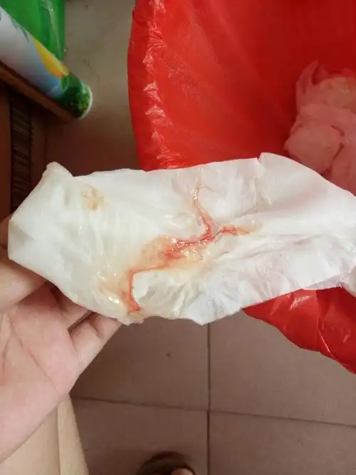 宝妈们,这是见红吗?