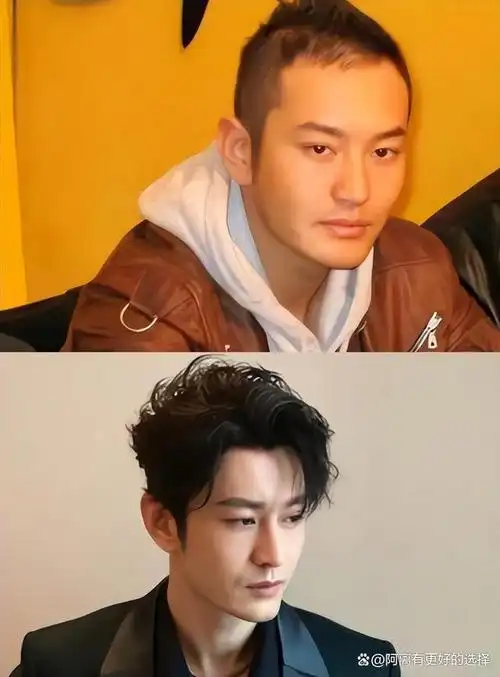 看到他的变化,网友围绕着黄晓明植发还是戴假发的问题展开热烈地讨