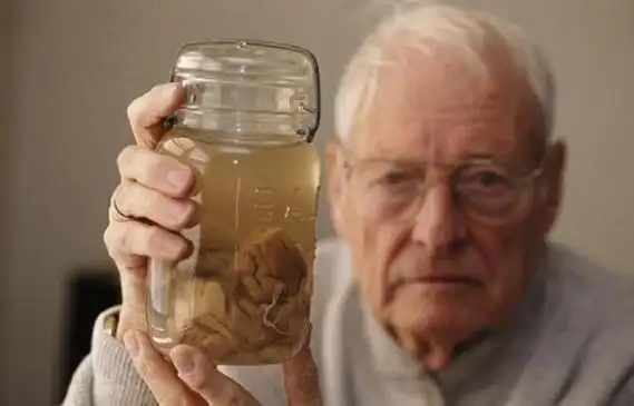 65年前,有人偷走爱因斯坦大脑,并切成240片,研究出了啥?