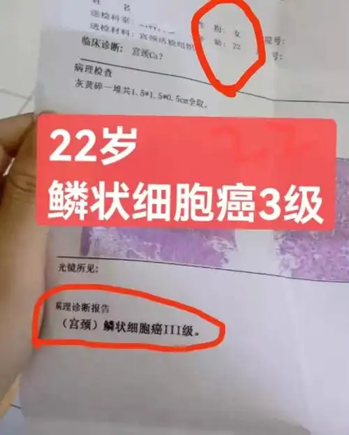 刚刚又听到几个宫颈癌的患者恐惧除了心痛