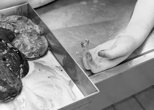 让尸体说话 实拍法医处理尸体全过程