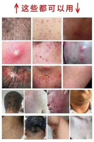 猫咪性乳药膏止痒头部头皮屁股日光毛囊炎外阴畜牧