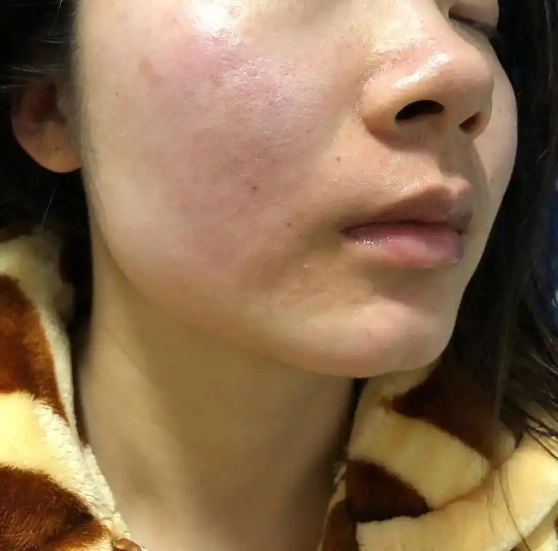 姐妹们帮我看看这是不是屏障受损