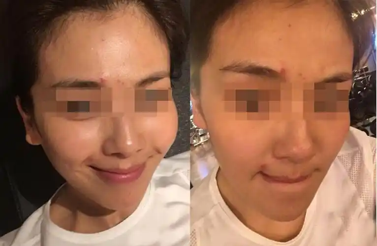 假期熬夜皮肤差?我连通宵都不怕